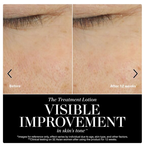 La Mer - The Treatment Lotion - Picture 2 of 9